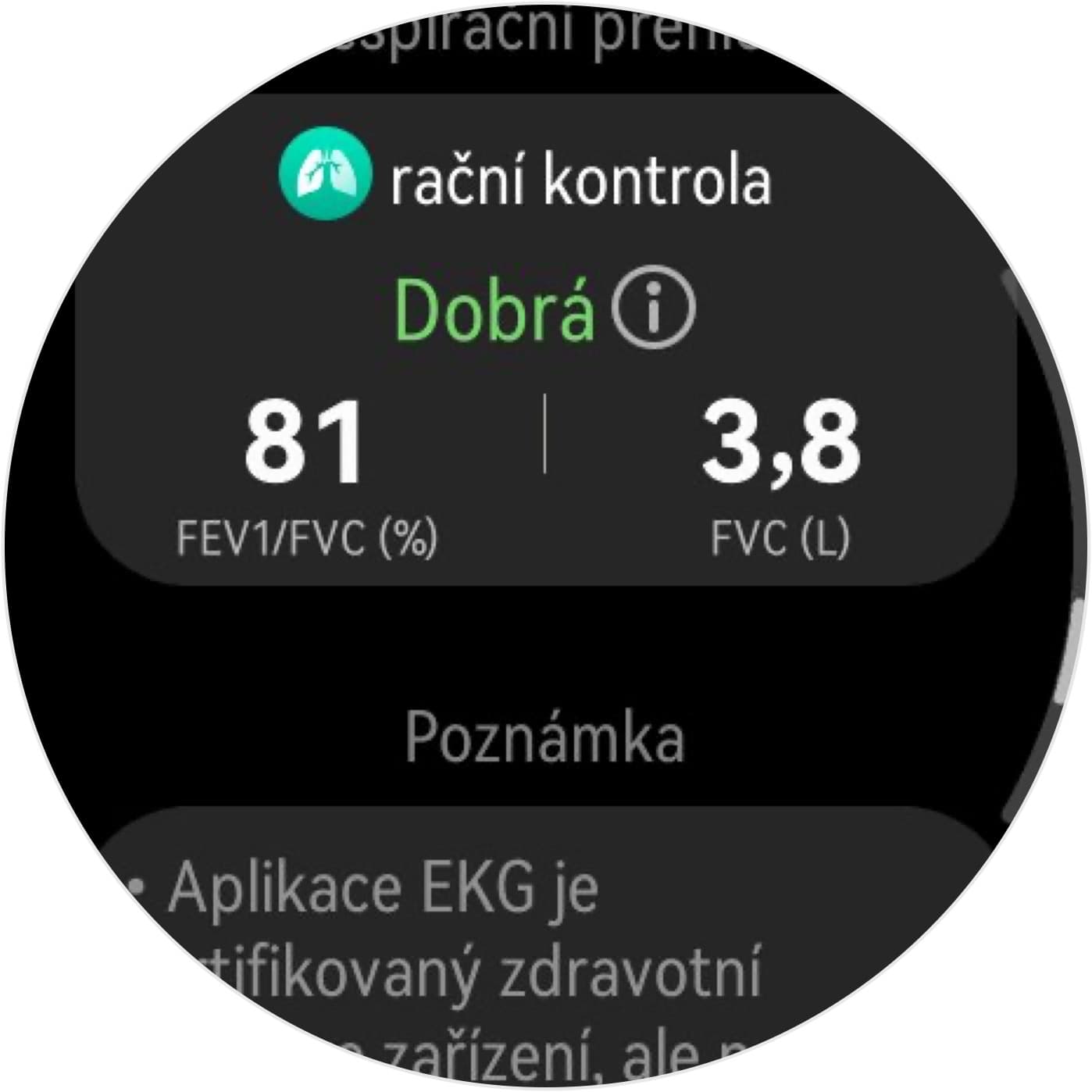 Respirační kontrola