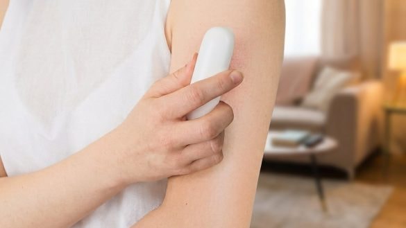 Honem do Actionu. Za 249 Kč má hit, který řeší letní problém mnoha Čechů
